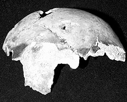 Теменная часть черепа Гитлера с отверстием от пули (фото: ИТАР-ТАСС)