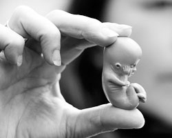 Опыт запрета официальных абортов уже был. В других странах. И заканчивалось все не так, как хотелось бы законодателям (Фото: Reuters)