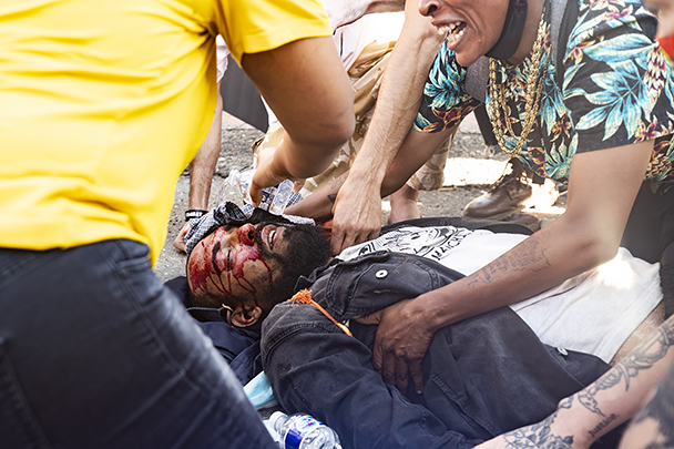 Во время столкновений сильно пострадал только один человек, ему тут же оказали необходимую помощь