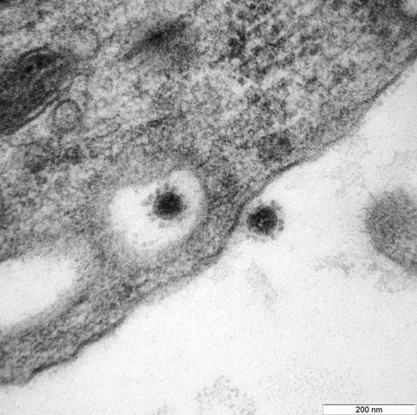 Впервые опубликовано фото дельта-штамма коронавируса. Российский центр вирусологии и биотехнологии «Вектор» вырастил вирус на культуре клеток эпителия почки африканской зеленой мартышки. Изображения сняты на камеру электронного микроскопа