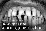 Болезни зубов и плохой запах изо рта отталкивают от курильщиков&#160;(фото: Совет при интеграционном комитете ЕврАзЭС)