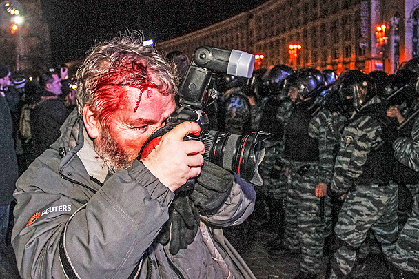 Среди пострадавших в ходе беспорядков оказались журналисты
