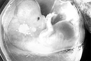 В США получены первые клоны эмбриона человека