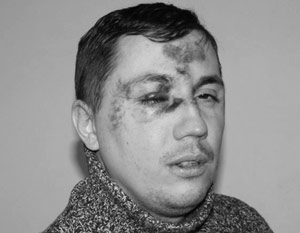 Никита Слепнев стал жертвой жестокого нападения за свою политическую позицию