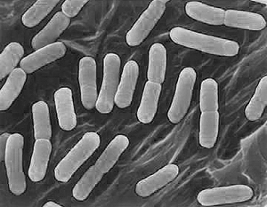 Эксперты: Кишечная инфекция в Европе вызвана новым штаммом бактерии