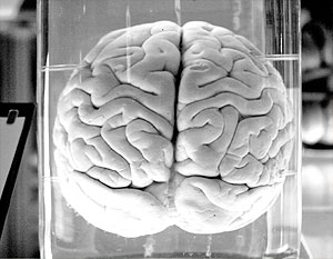 Эксперты полагают, что вмешательство в работу мозга может иметь слишком много побочных последствий