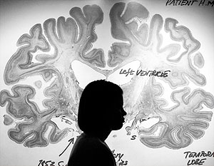 Ученые: Человеческий мозг больше не способен развиваться