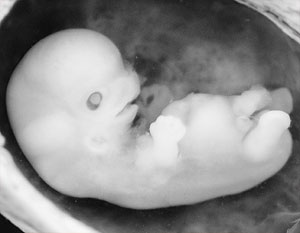 По мнению Милонова, незакрепленное право на жизнь для эмбрионов – упущение Конституции