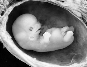 Депутаты не стали наделять эмбрионы правами
