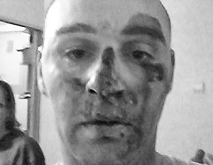 ГИБДД опровергла избиение инспектором активиста «Синих ведерок»