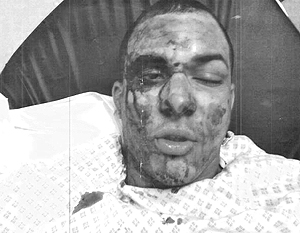 Исламисты жестоко избили пьющего пиво на улице Лондона студента