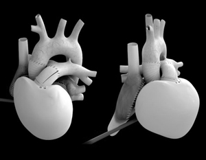 Врачи впервые вживили пациенту полностью автономное искусственное сердце
