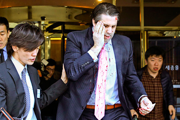 Посол США в Южной Корее Марк Липперт подвергся нападению представителя левой партии, который требовал объединения Северной и Южной Кореи. Липперт получил ранение руки и лица. Его жизни ничего не угрожает.