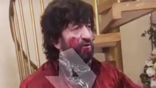 На «Короля мерседесов» напали с ножом в новогоднюю ночь