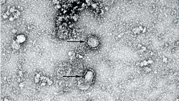 Опубликовано первое изображение китайского коронавируса