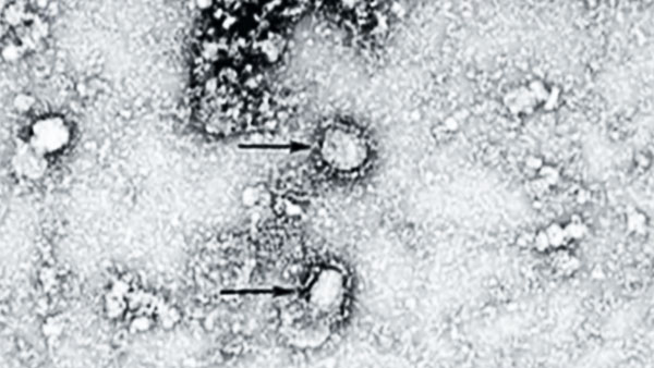 Уханьский коронавирус проник в Германию