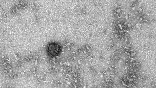 Опубликована фотография коронавируса под микроскопом