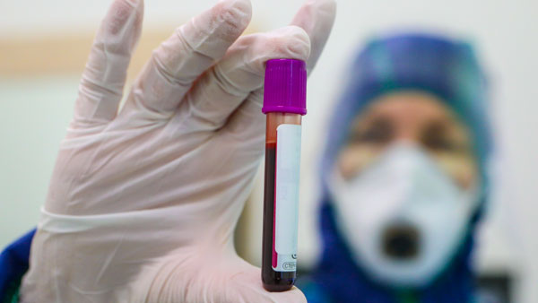 Официально названа самая уязвимая группа крови для коронавируса