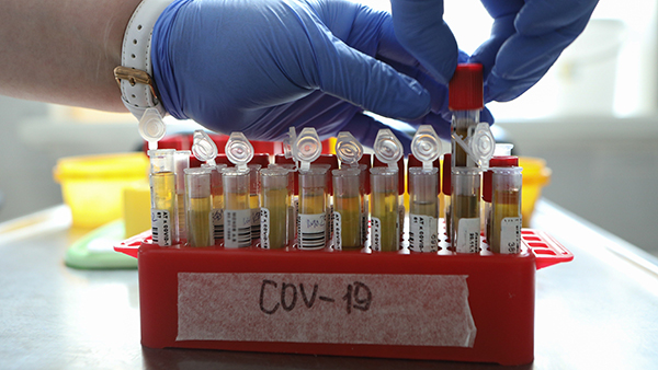 В России подтвердили 8,8 тыс. новых случаев коронавируса