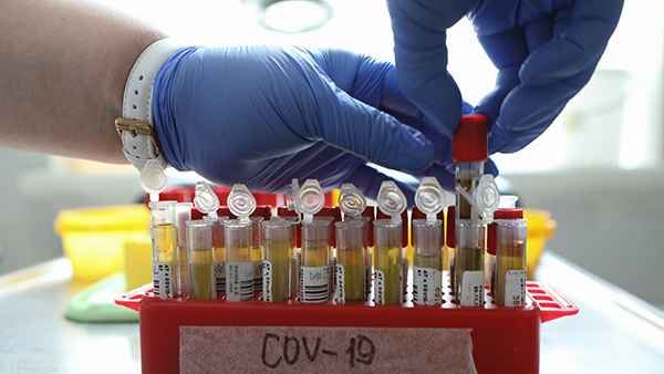 В России подтвердили 5,5 тыс. новых случаев коронавируса