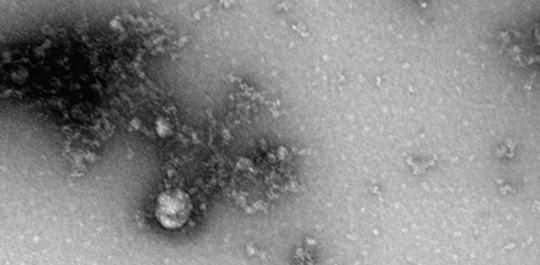В России получили первое в мире изображение «британского» штамма коронавируса