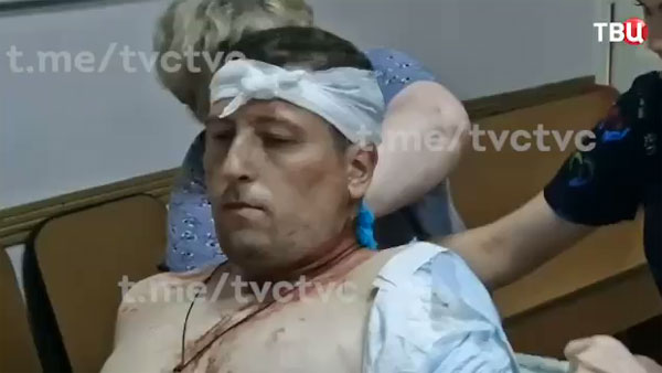 Журналист «ТВ Центра» ранен в Донецке