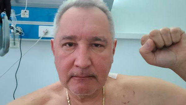 Рогозин опубликовал первое фото после операции