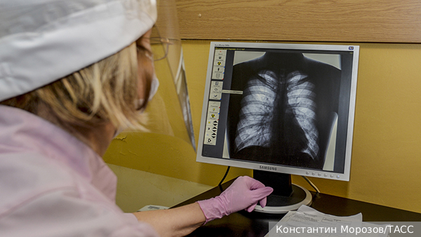 В России выявили несколько случаев микоплазменной пневмонии 