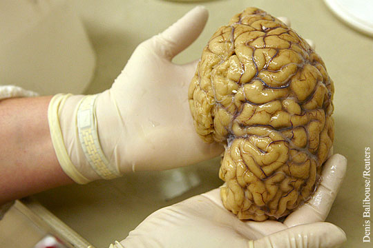 Американские ученые вырастили в лаборатории человеческий мозг