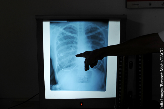 Роспотребнадзор предупредил о разгуле туберкулеза на Украине