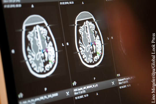 В США разработали имплант для стимуляции мозга